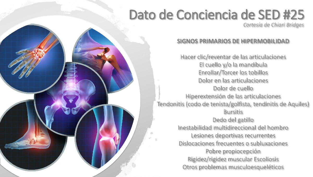 Dato de conciencia de SED #25