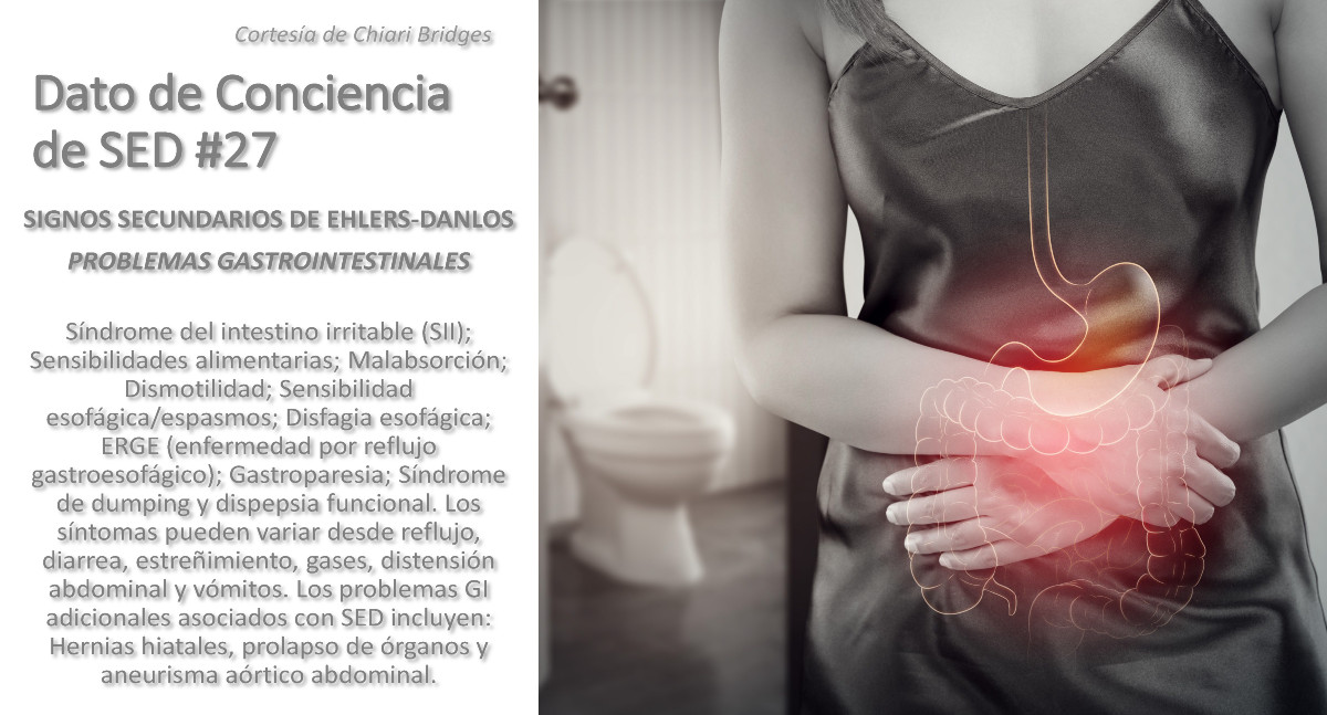Dato de conciencia de SED #27