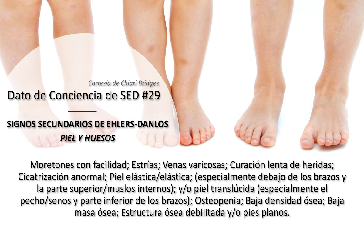 Dato de conciencia de SED #29