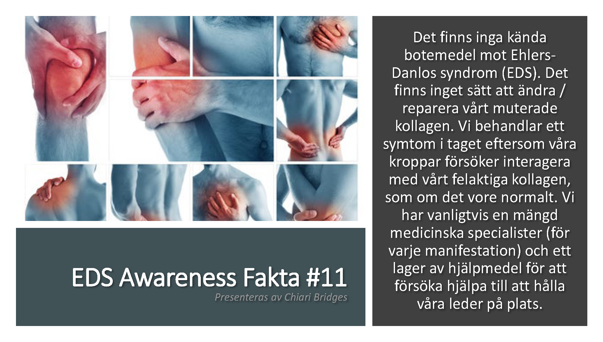 EDS Awareness Fakta #11