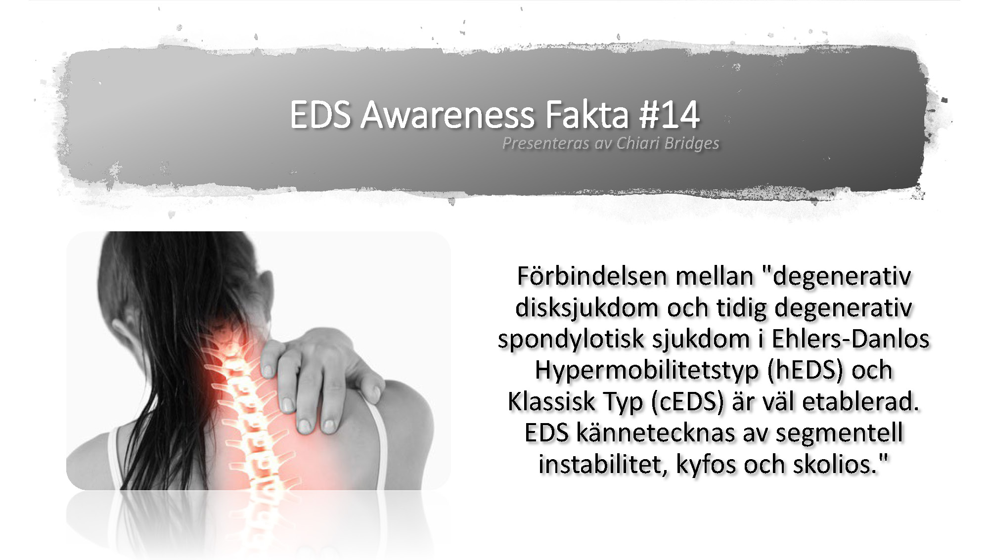 EDS Awareness Fakta #14