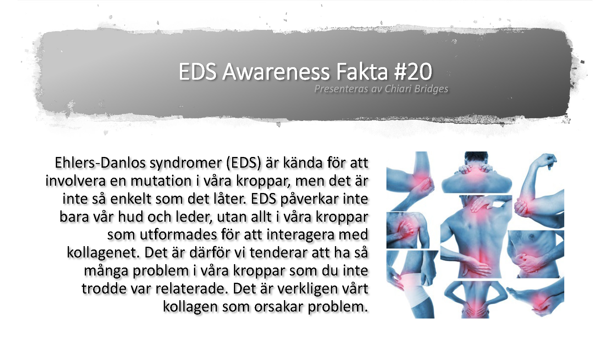 EDS Awareness Fakta #20