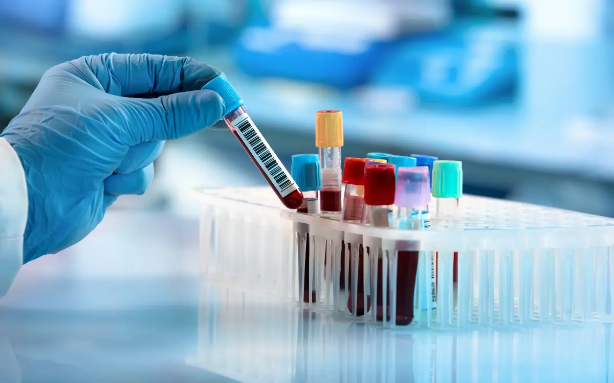 Baseline & Routine Labs for Complex hEDS, POTS, & Neuro-Autoimmune Conditions